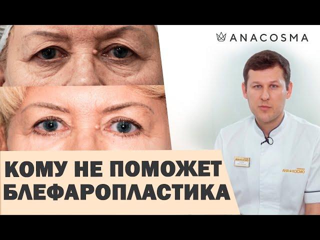 ️Блефаропластика: КОМУ НЕ ПОМОЖЕТ? ️️Нависшее веко как убрать ️БЕЗ ОПЕРАЦИИ️ Миронов Андрей