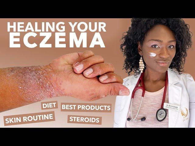 How to Treat ECZEMA-Atopic Dermatitis: Black Dark Skin, Dry Flaky Skincare Routine Hyperpigmentation