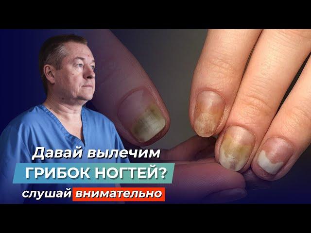 ШОКИРУЮЩАЯ ПРАВДА ПРО ГРИБОК НОГТЕЙ! Как вылечить ОНИХОМИКОЗ самостоятельно?