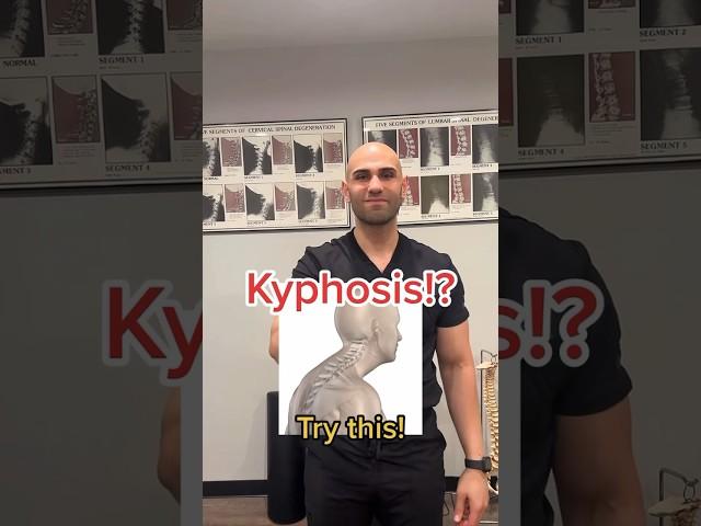 Kyphosis / Bad Posture? Try and share! #shorts #kyphosis #posture #tips #viral #fyp