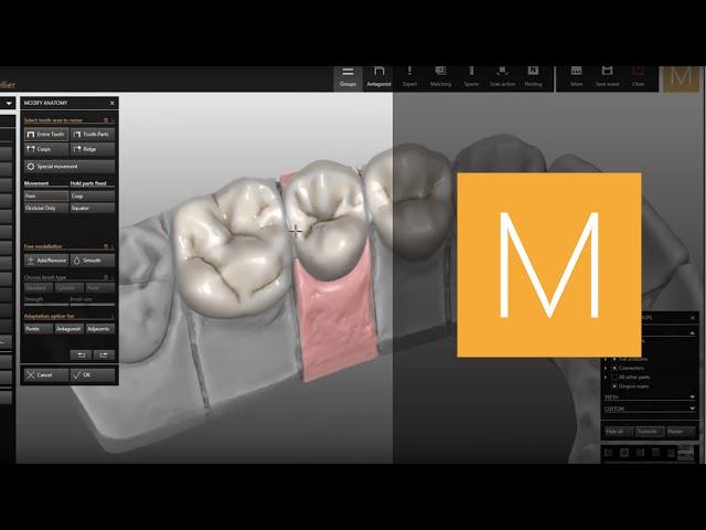 Reality Mode CAD/CAM module of Zirkonzahn.Modellier | Zirkonzahn.Software