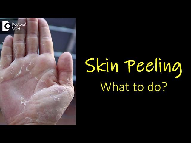 What causes skin peeling from fingers and feet? How to manage? - Dr. Rasya Dixit