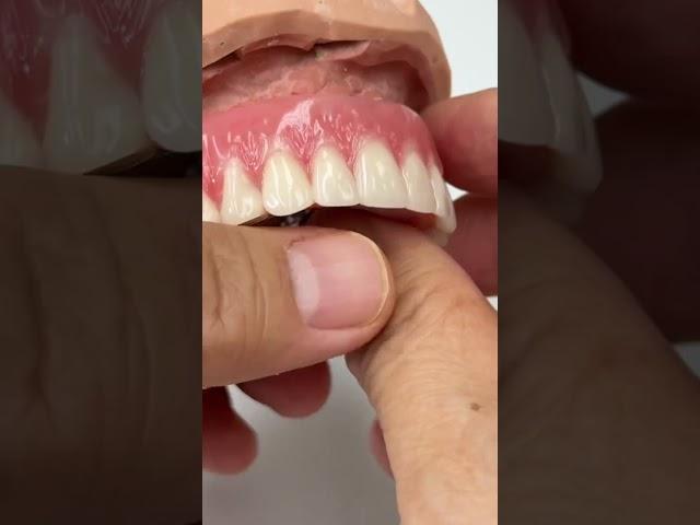 Removable denture!