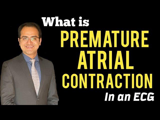 Premature Atrial Contraction/Complex (PAC) ECG Interpretation Atrial Rhythms, Treatment, USMLE