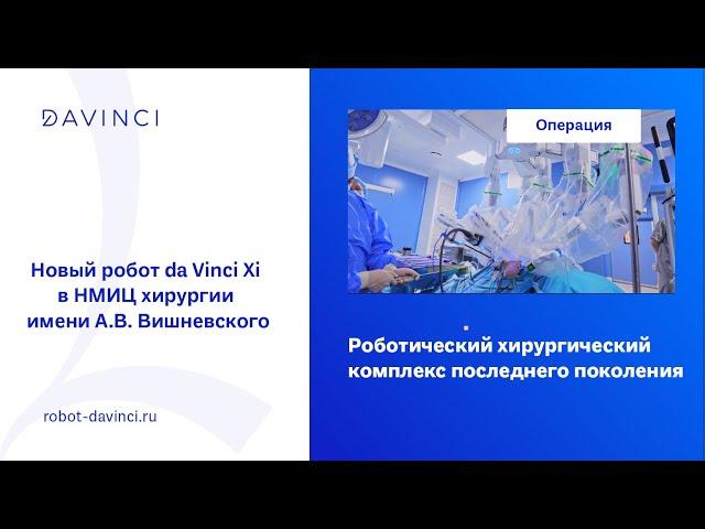 Новый робот da Vinci Xi в НМИЦ хирургии имени А.В. Вишневского