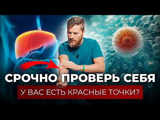 О чем говорят КРАСНЫЕ ТОЧКИ на теле. Гемангиома - опухоль или слезы печени?