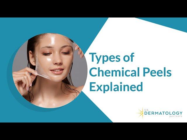 Types of Chemical Peels | Peels for Hyperpigmentation & Acne