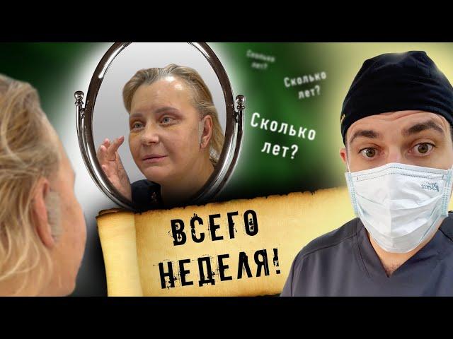 Омоложение лица: до и после