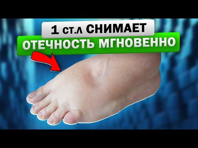 Как старый терапевт спас меня от отёка конечностей! Отек ног - важно