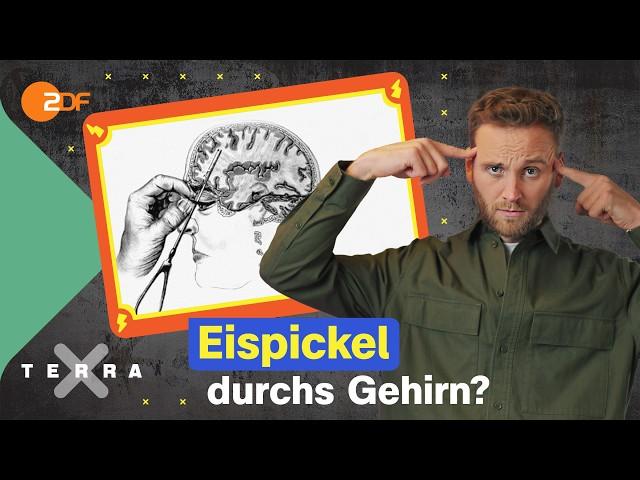 Brutale Lobotomie: Wie sind wir heute geschützt? | Brain Projects |Terra Xplore mit Leon Windscheid