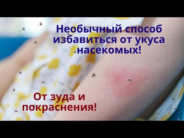 Лето! Комары и мошки. Самопомощь при укусе насекомых: чем помазать и как убрать зуд?