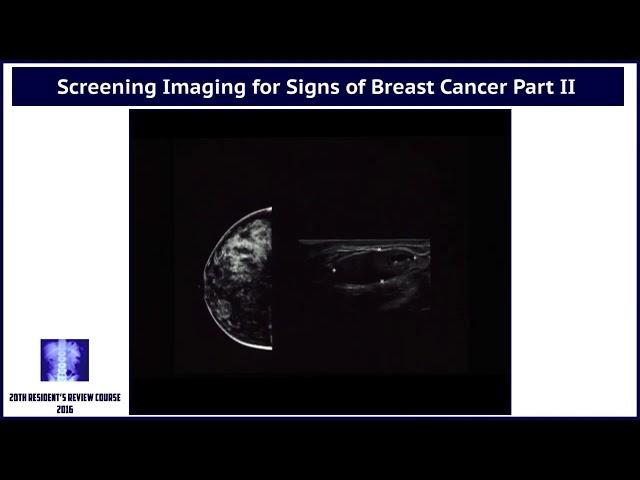 Screening Imaging for Signs of Breast Cancer - Part II