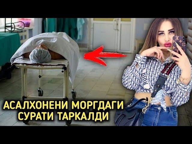 #ВАХШИЙЛИК АСАЛХОНЕЙ ЭКПЕРТИЗА МОРГ РАСМЛАРИ!#asalhoney