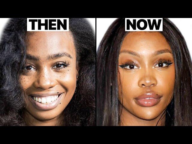 SZA New Face | Plastic Surgery Analysis