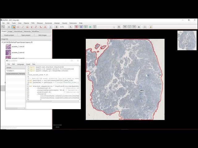 Nuclei segmentation based on stardist with QuPath