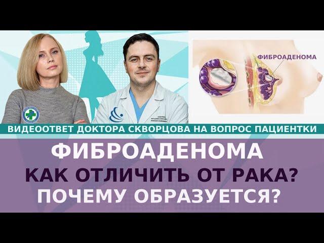 Фиброаденома: как отличить от РМЖ? Почему образуется?