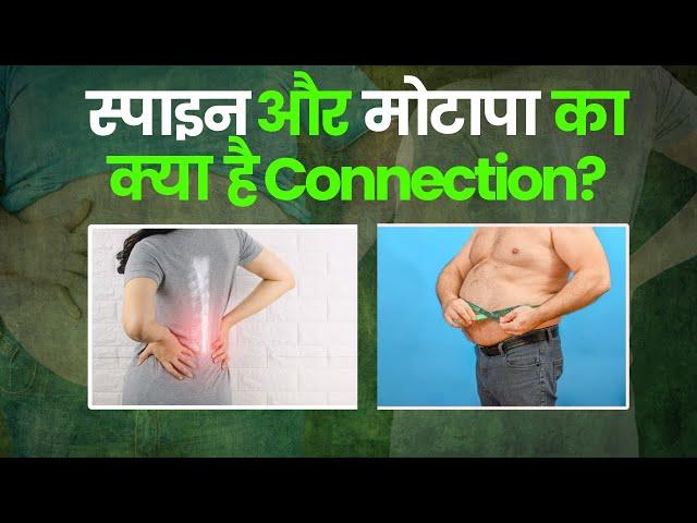 मोटापे और रीढ़ की समस्या का क्या संबंध है? World Spine Day 2024 I OnlyMyHealth