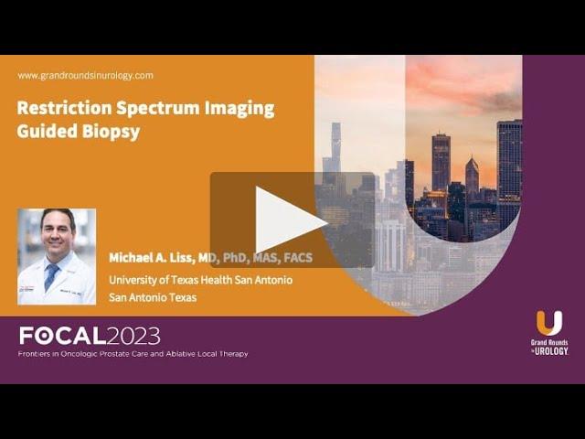 Restriction Spectrum Imaging (RSI) Guided Biopsy