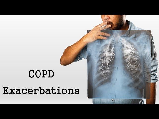 COPD Exacerbations