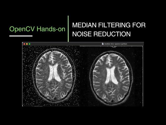 15. Median Filtering for Noise Reduction in OpenCV | OpenCV Tutorial