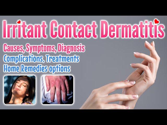 Irritant contact dermatitis overview, causes, symptoms, treatment options and home remedies