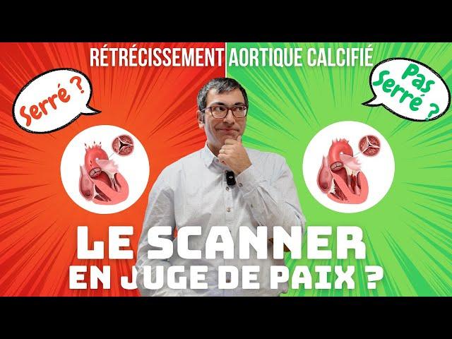 Serré ou pas serré ? Comment le SCANNER aide à l'évaluation du Rétrécissement Aortique