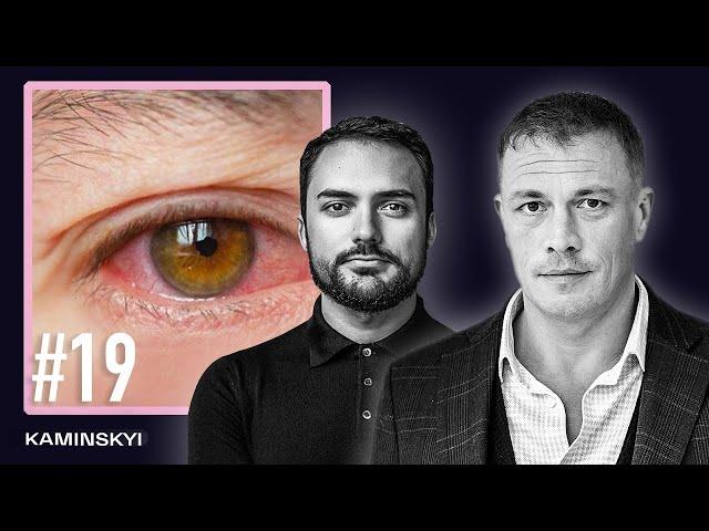 ENG SUB. Ophthalmic complications. LASER CORRECTION. Dr. Alexander Teslenko. HIT-FUCKUP / KAMINSKYI