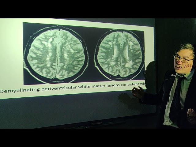 MRI neuroop pearls