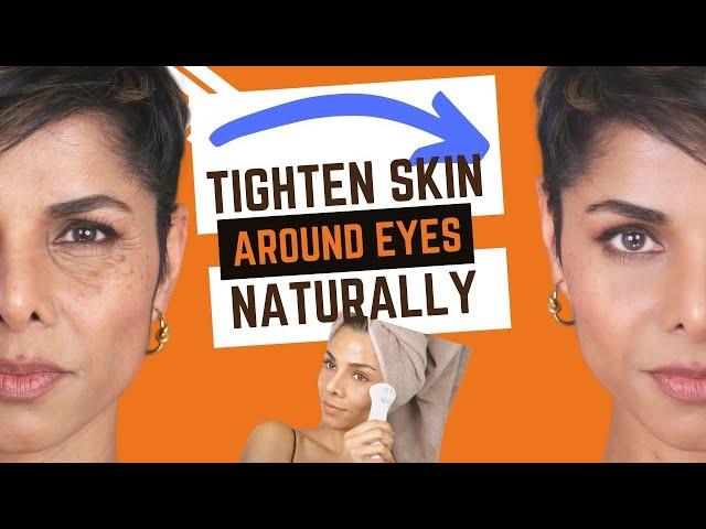 How To Tighten Skin Around Eyes Naturally Without Injecting Fillers