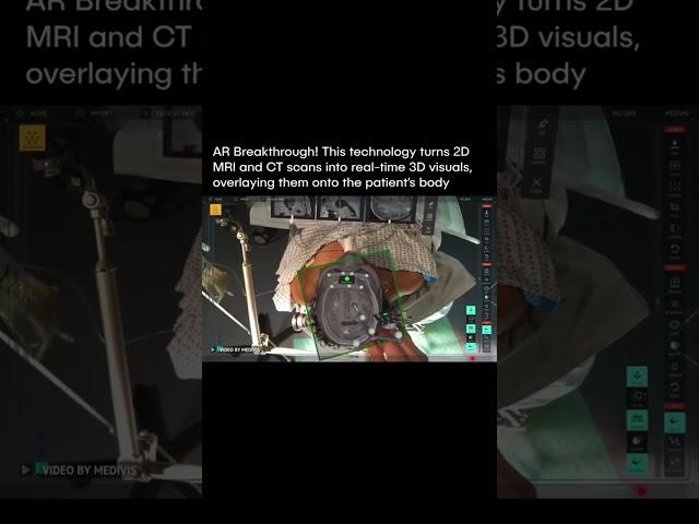 Follow for more! #tech #news #breakingnews #viral #robot #ai #doctor #3d #technology