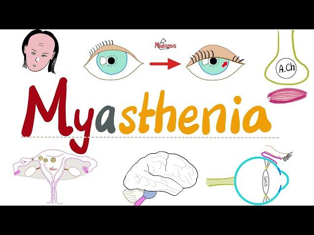 Myasthenia Gravis (MG) - Muscle weakness & Fatigue - Causes, Symptoms, Diagnosis, Treatment - Neuro