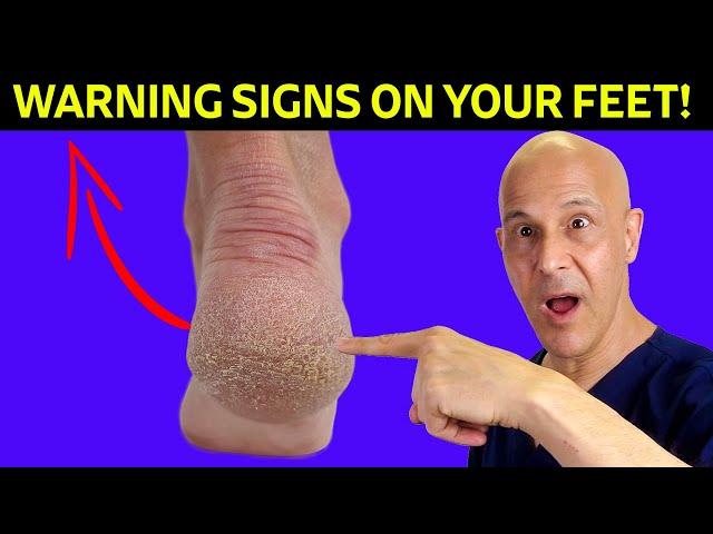 Your Feet Are Warning You About Nutrient Deficiencies – Pay Attention!  Dr. Mandell