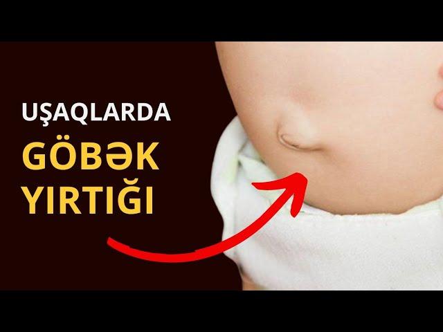 GÖBƏK YIRTIĞI: Özü sağalır? / Toğrul Ömərov