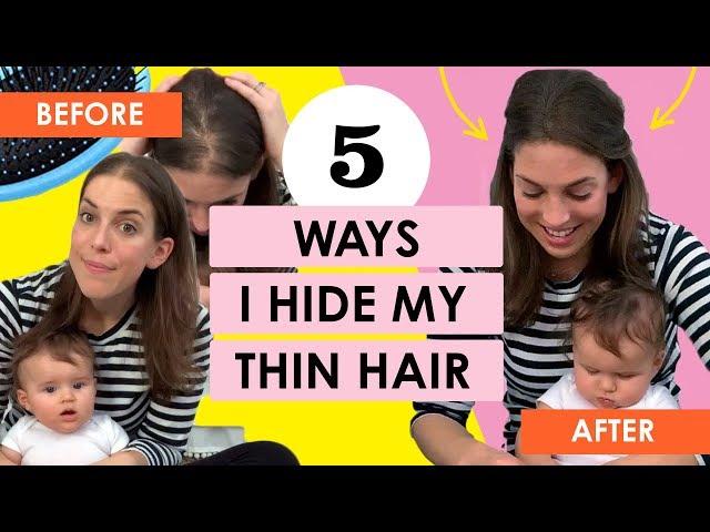 5 Ways I Hide My Thin Hair (Postpartum Hair Loss)