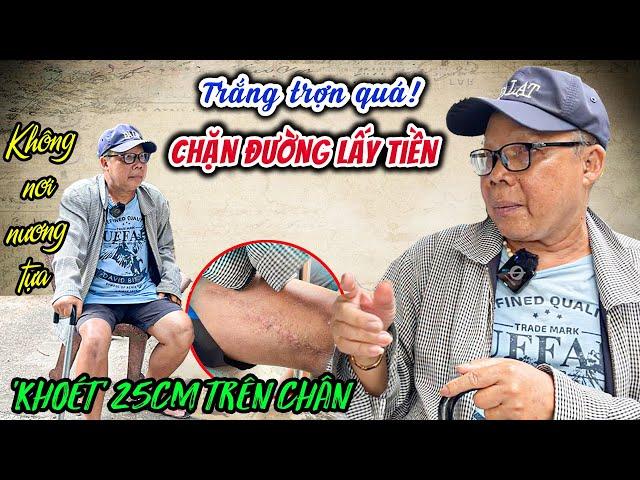  SỐC CHƯA? BỊ CHẶN ĐƯỜNG ĐÒI 'CHIA' TIỀN TỪ THIỆN, ÔNG GIÀ CÔ ĐƠN BẬT KHÓC VÌ BỆNH KHÔNG LỐI THOÁT