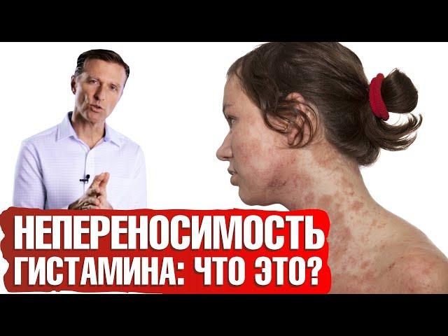 Что такое непереносимость гистамина? Пищевая непереносимость - что делать‍️