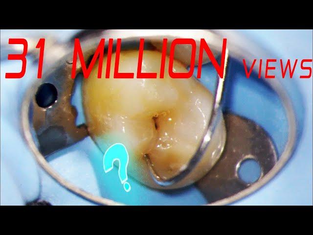 How I film viral dental videos