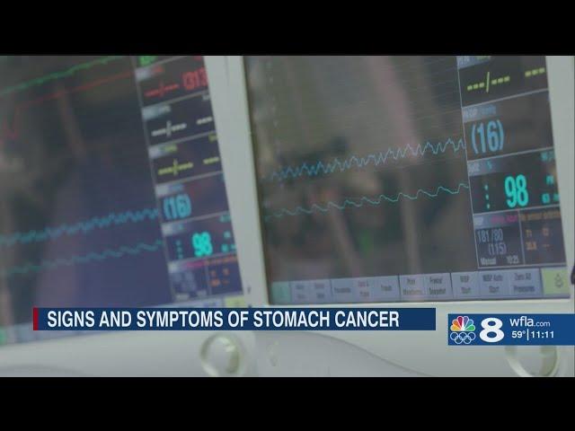 GI experts warn of stomach cancer symptoms, share preventative measures