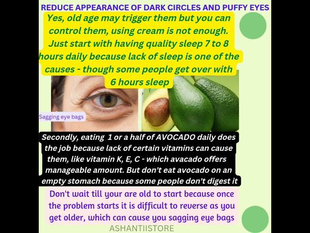 #healthytips #eyebag #darkcircles #ashantiistore  - HOW TO PREVENT EYE BAGS AND DARK EYE CIRCLES