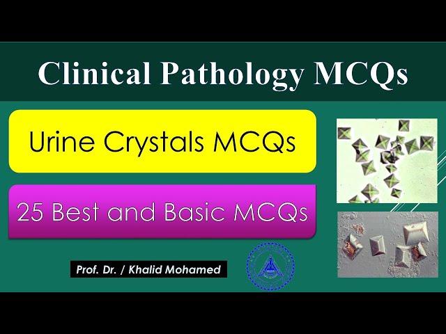 Urine analysis Part 4:  Best MCQs on Crystals in urine sediment