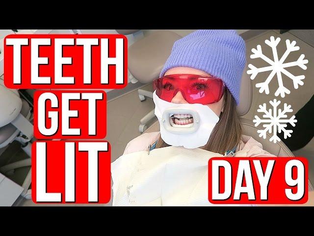 GETTING MY TEETH DONE! Vlogmas Day 9 | Meredith Foster