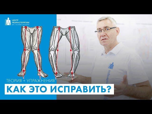 Как ножки сделать прямыми с помощью упражнений?