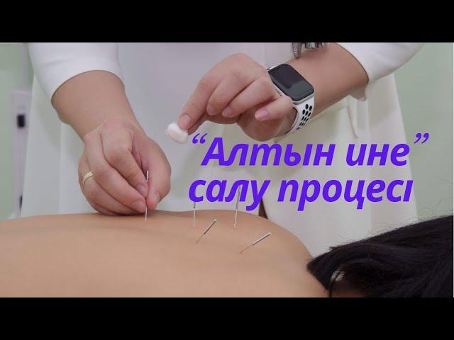 Алтын ине салу