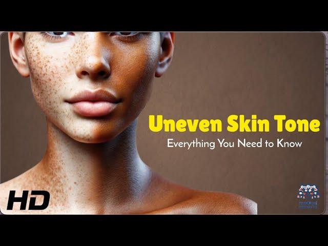 Best Skincare Tips to Fix Uneven Skin Tone