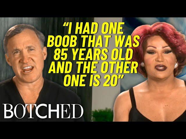 Dr. Dubrow Fixes Flame Monroe's Lopsided Breast Implants | Botched | E!