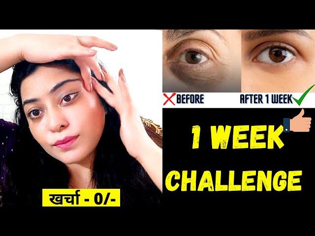 आंखों के नीचे गड्ढे,धंसी हुई आंखें, Dark circles & Wrinkles को 7 दिन में गायब करने का रामबाण नुस्खा