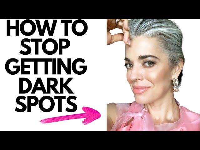 HOW TO STOP GETTING DARK SPOTS | Nikol Johnson