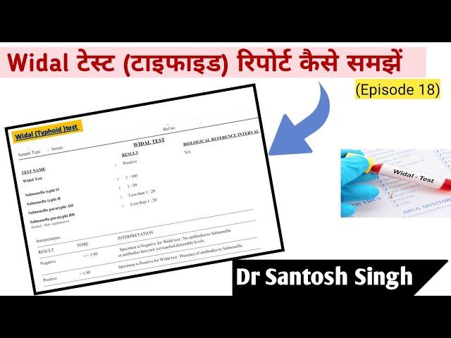 How To Read Widal Test Report? Typhoid | Dr Santosh Singh | (Episode 18)