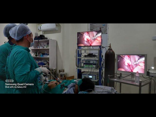 Lap App + Ooophrectomy