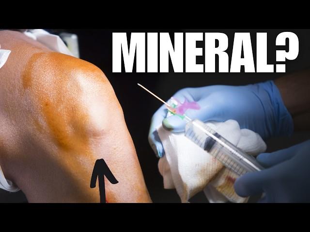 No.1 mineral prevents knee osteoarthritis! It eliminates pain,cartilage damage...